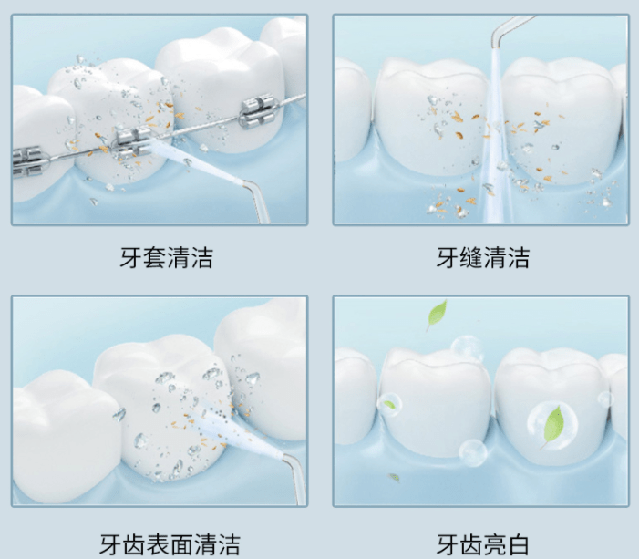 口腔老余水牙线的好处与坏处危害深度科普