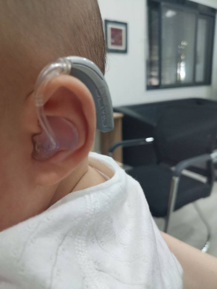 婴儿助听器图片
