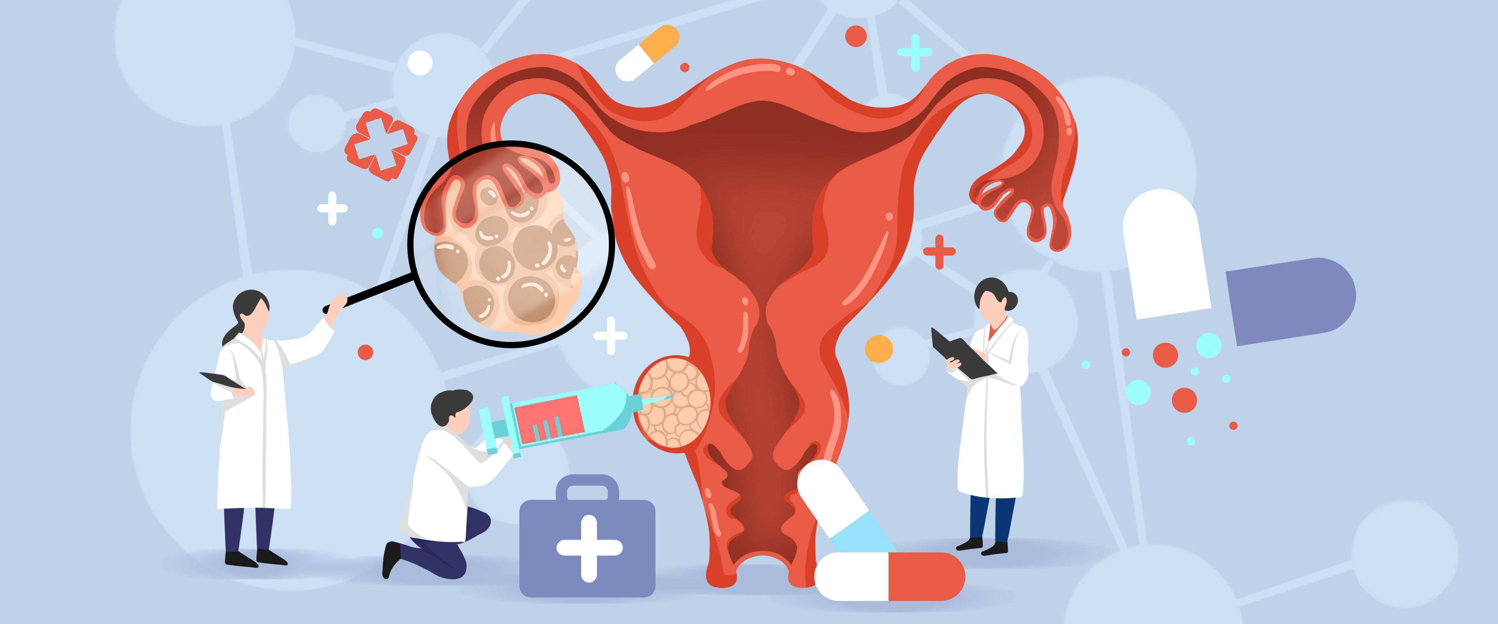 原创
            为什么卵巢癌一发现就是晚期？出现这些症状可能是卵巢在向你“求救”~
                
                 
