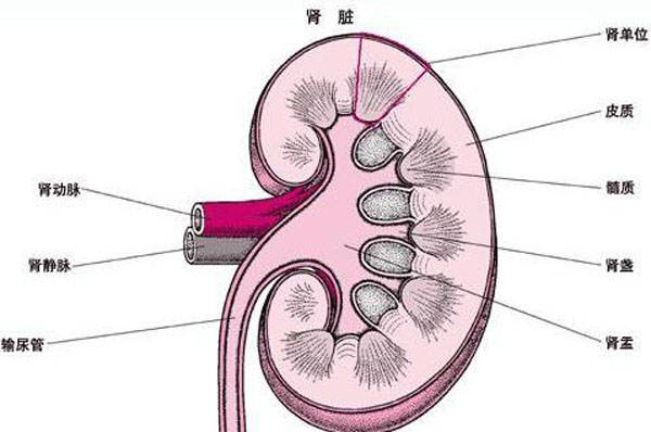 急性肾盂肾炎表现为与感染相关的急性间质炎症和肾小管坏死,患者有