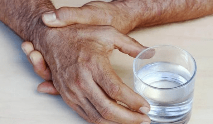 如何判断手抖是特发性震颤?_发病_临床_饥饿