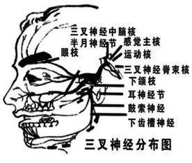 三叉神經痛的觸發點分佈在哪些部位