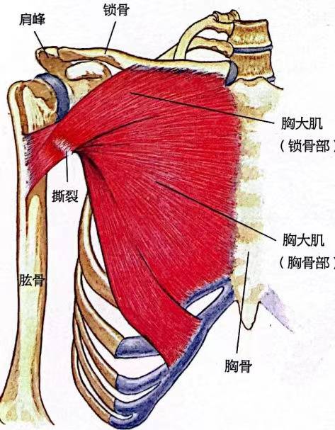 深圳跳绳培训 胸大肌拉伤