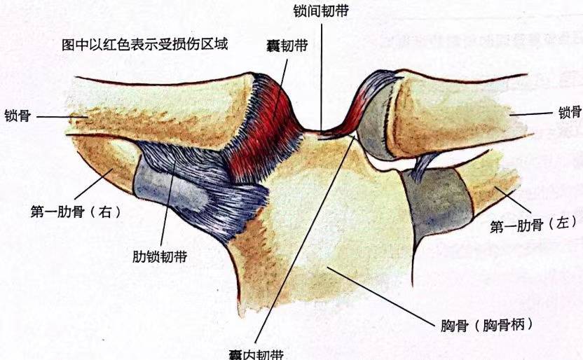 深圳跳绳培训:肩锁关节扭伤