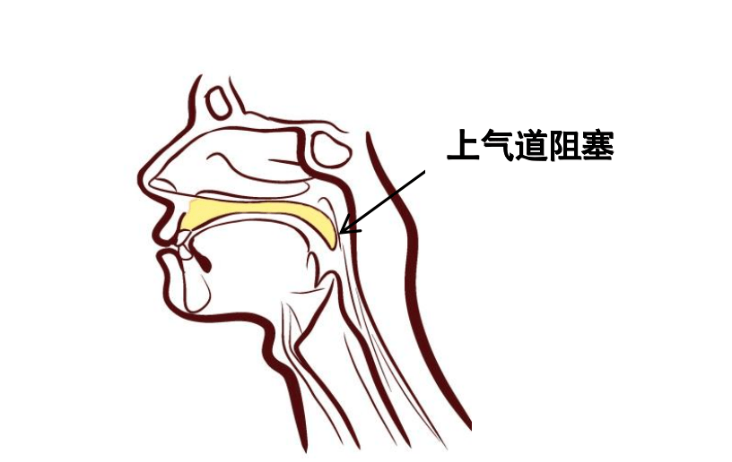 要掛哪個科?_睡眠_患者_功能