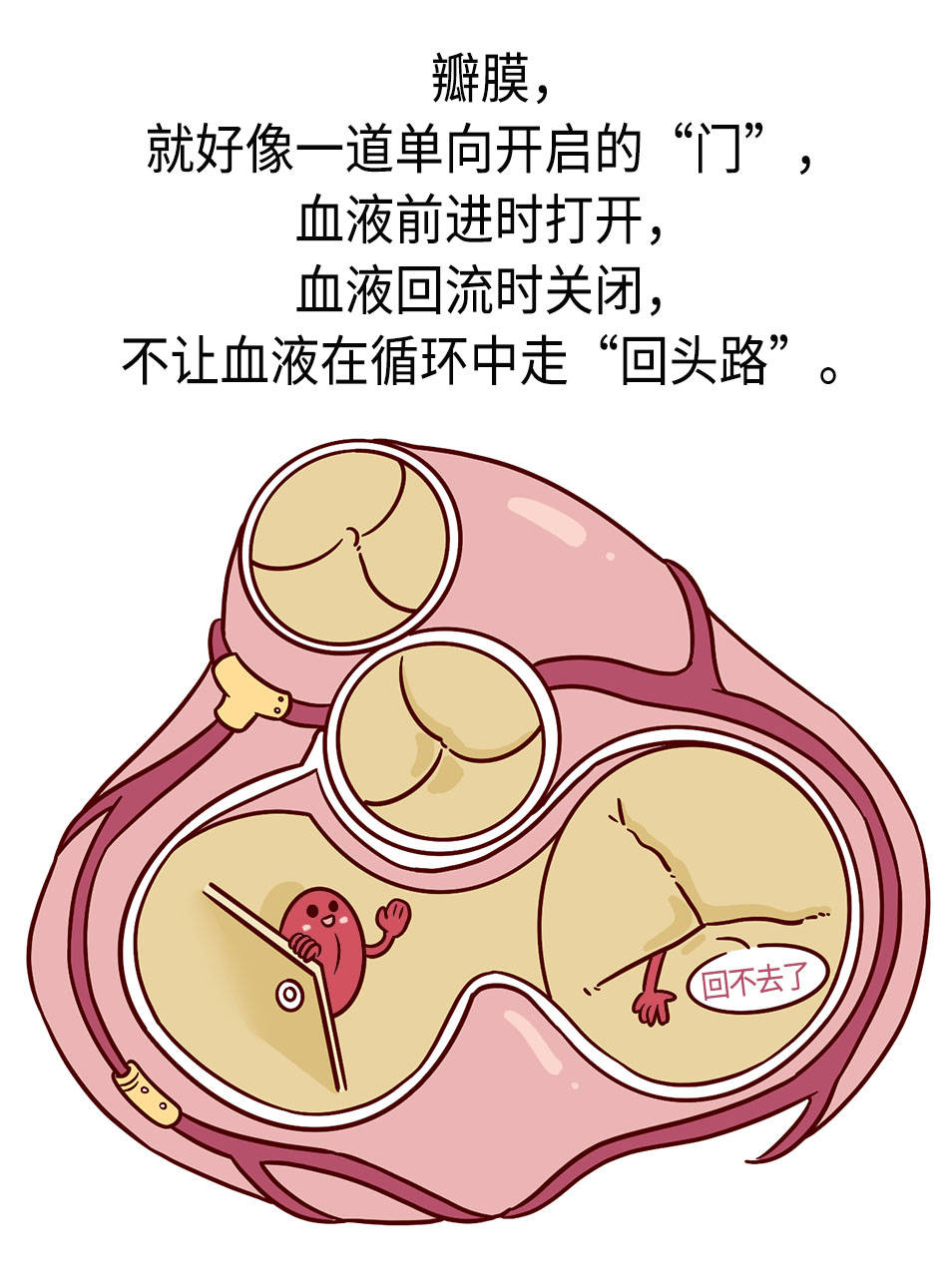 心脏三尖瓣反流图片图片