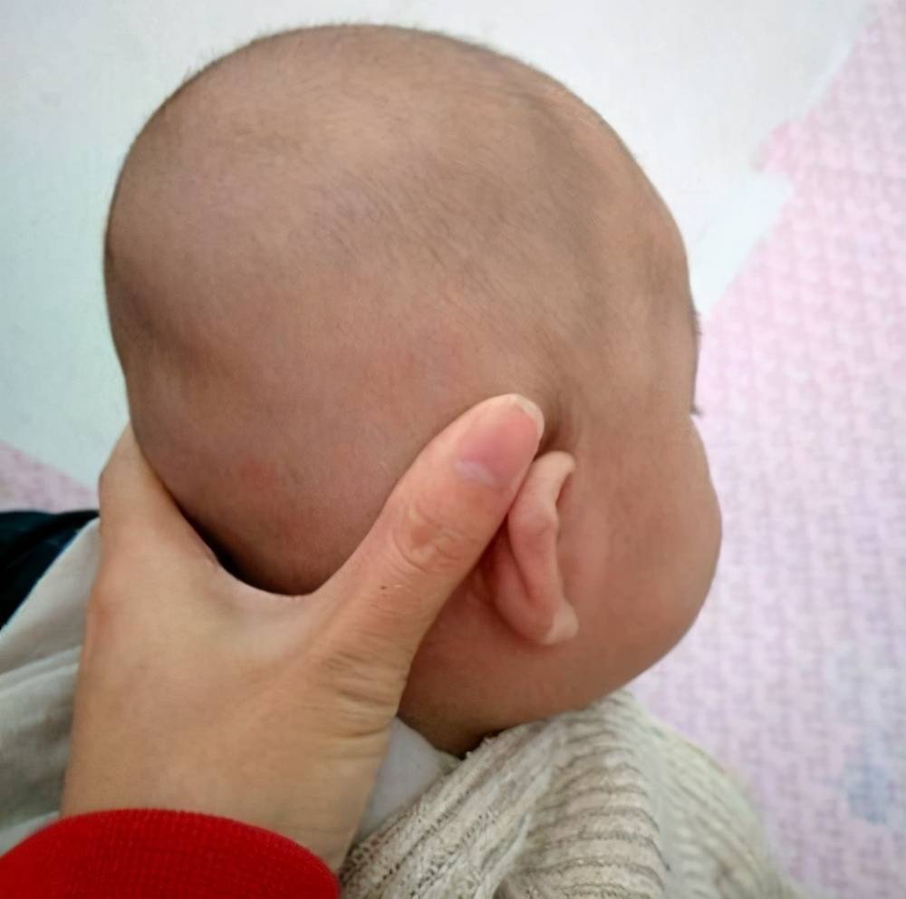 在正常情况下,宝宝出生后的头颅左右应该是对称的,不存在偏头一说