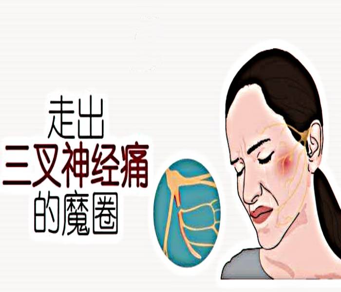 济南国医堂医院周振敏主任介绍-三叉神经痛是怎么得的_治疗_患者_面部