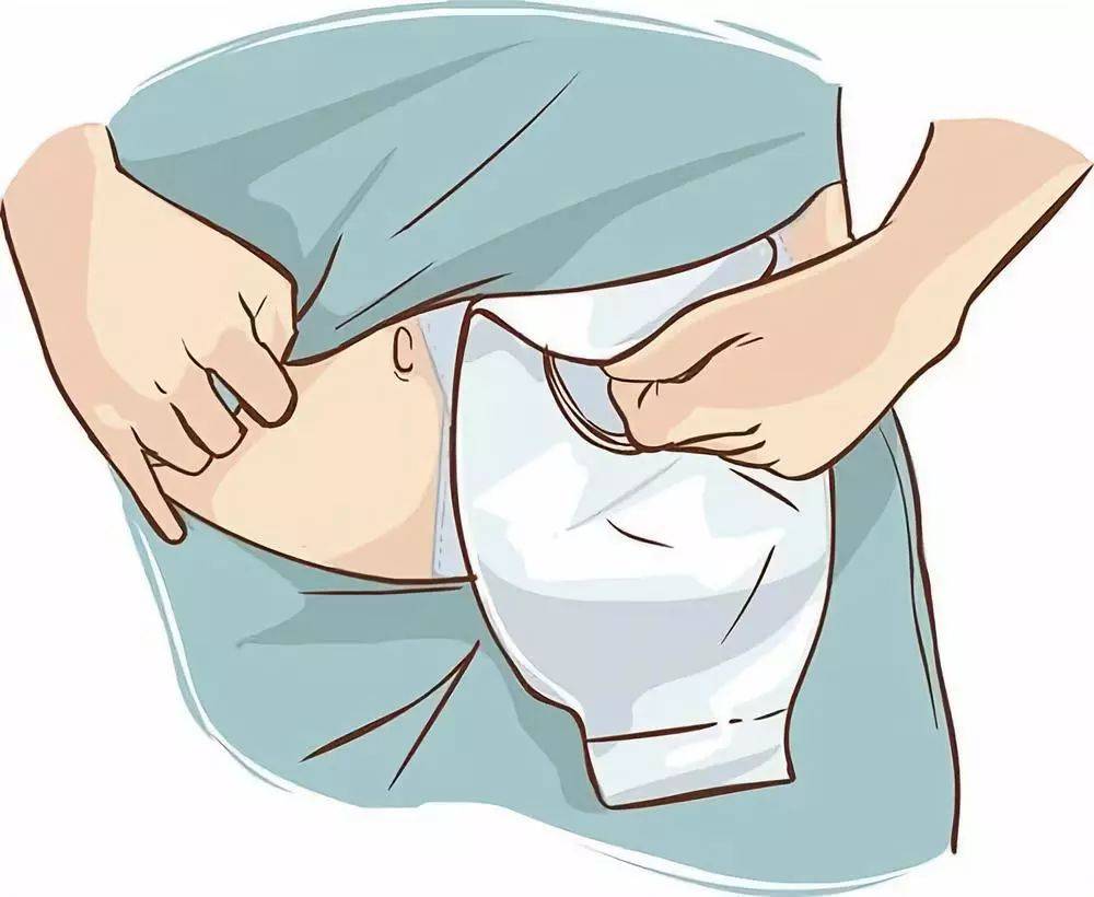 直肠完全闭合,也可以不带着「粪袋」走完余生_许女士_手术_肠道