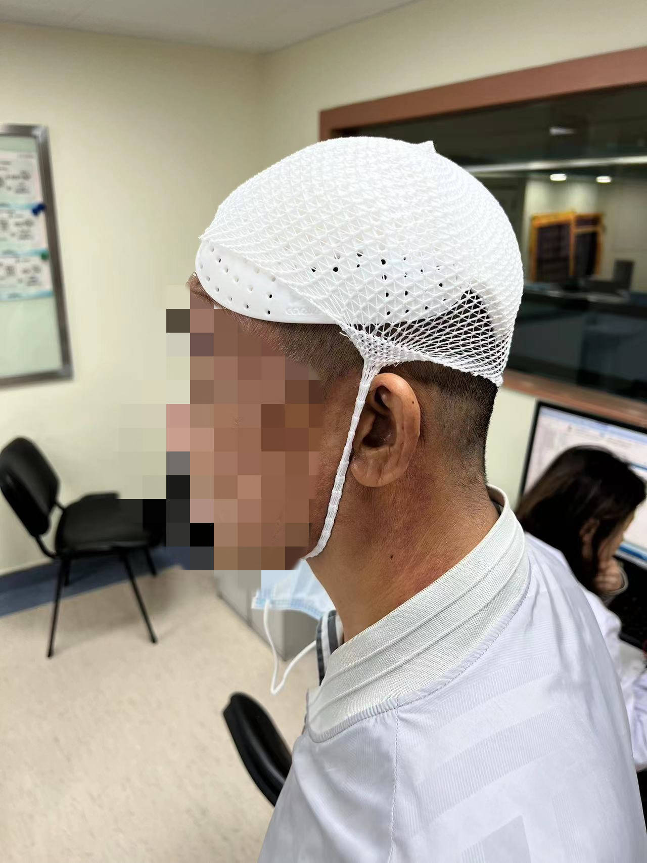 因此,赛纳数字医疗推出颅骨缺损保护帽,起到神经外科去骨瓣术后短期