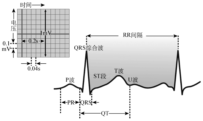 心电图纸上的波形代表什么,教你看懂心电图_mv_测量_振幅