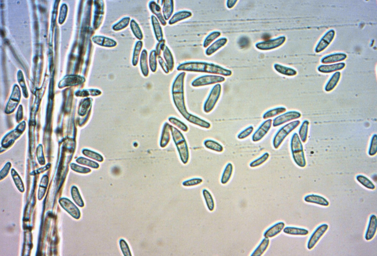根腐病怎样从根源上治理!_植物_病原菌_农业