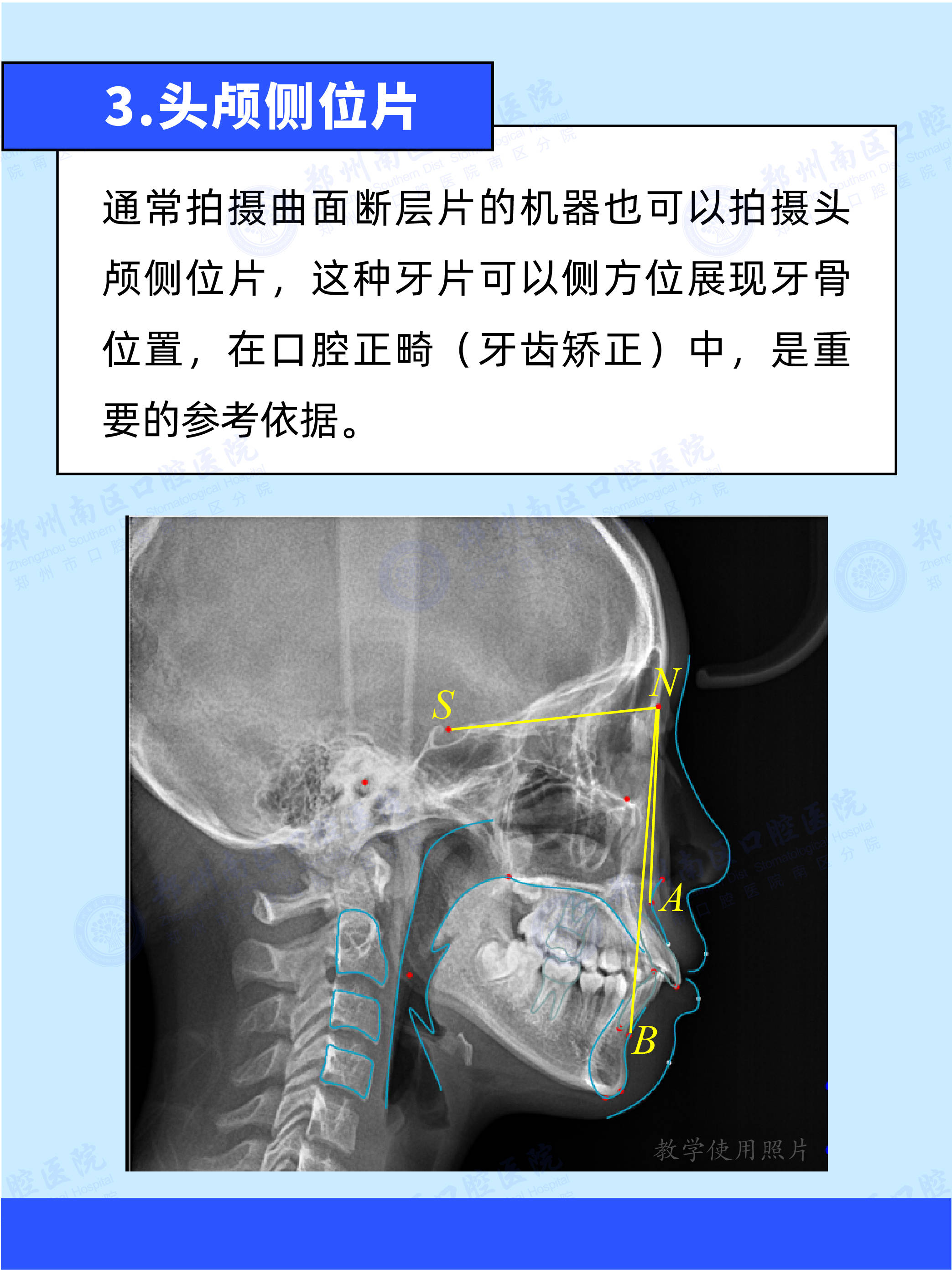 头颅里面长满牙齿图片