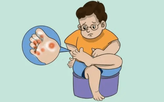 这几类人群更容易出现鸡眼,要多注意_摩擦_挤压_足部