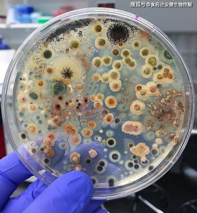 61 不应存在于任何加工过程中61 典型来源:- 水源污染(粪便污染)
