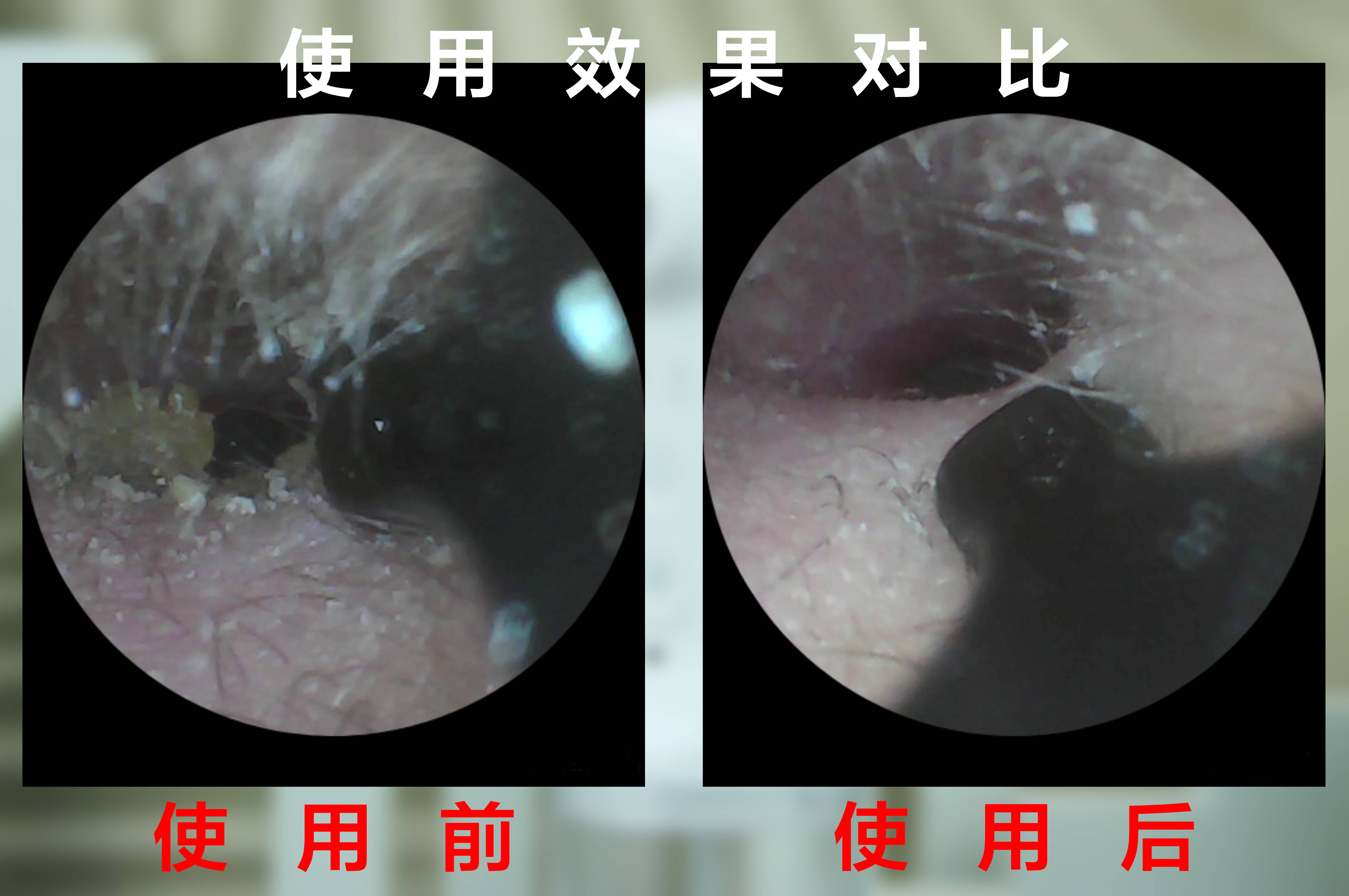 清洁耳朵的新选择,DOCO电动洗耳器,给耳朵SPA般的享受