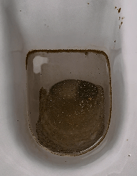 溶解马桶蹲便小便池里的尿碱的最佳的方法汇总_醋酸_盐酸_硫酸