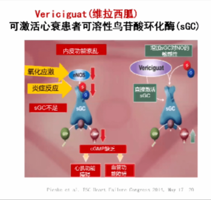 维拉西胍的作用机制示意图 综上所述,我国心衰患病率近十多年一直呈