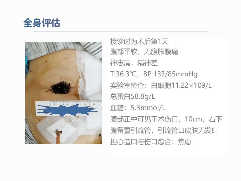 一例結腸癌術後腸造口缺血壞死護理查房