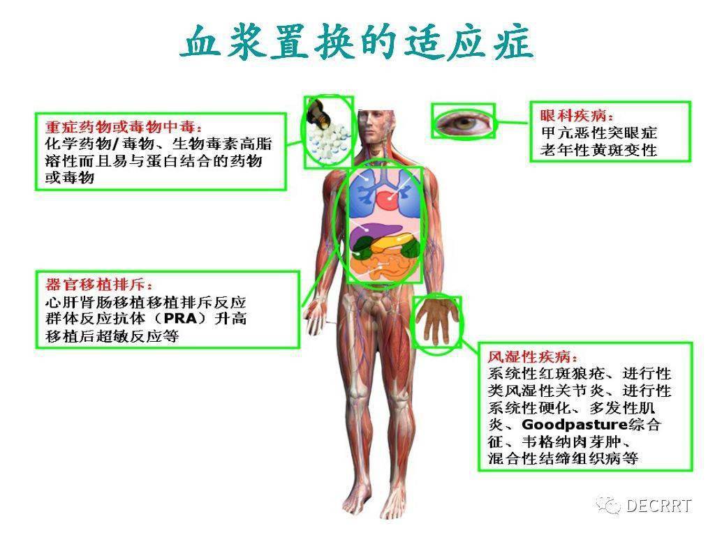 万物皆可盘血浆置换篇