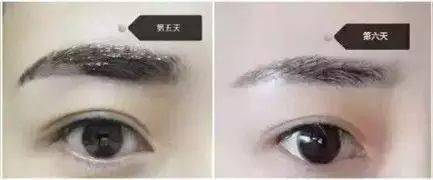 刚做完的眉毛前三天有点黑 是正常现象!修复期后就会自然一些
