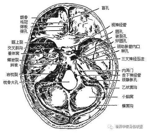颅中窝的孔裂图片