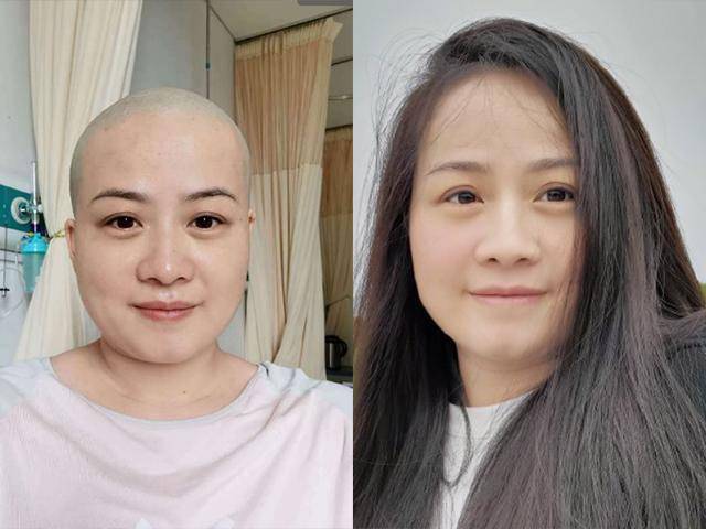 岳云鹏老婆生病剃光头引发网友担心回应只是小手术