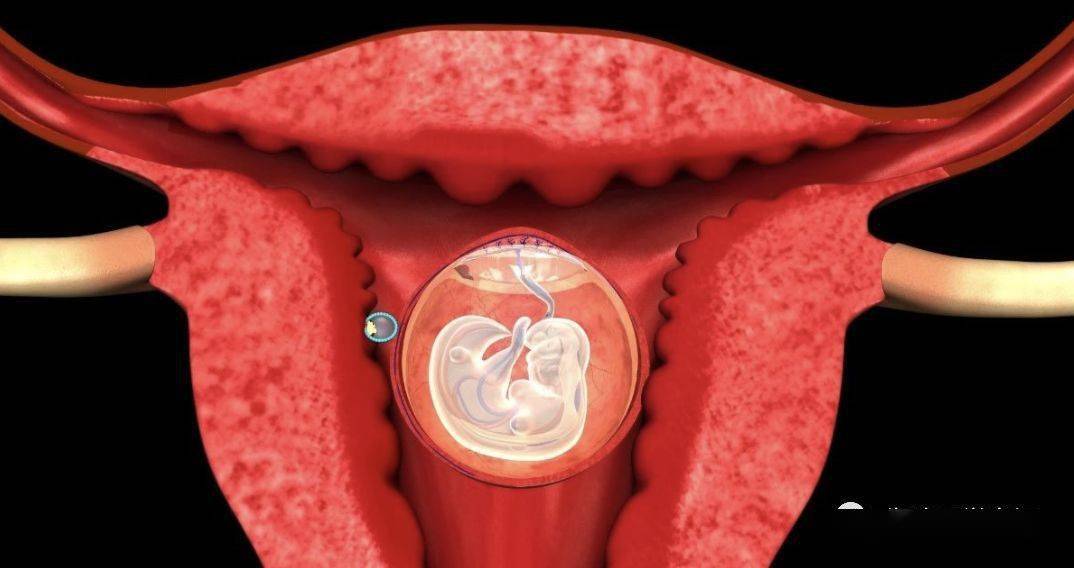 胚胎为什么停止发育逃不出这10个因素