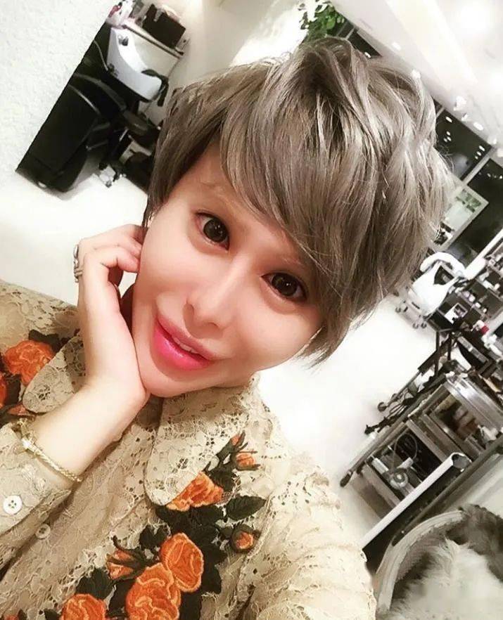 花2亿整容上百次!日本蛇精脸网红整形上瘾变外星人