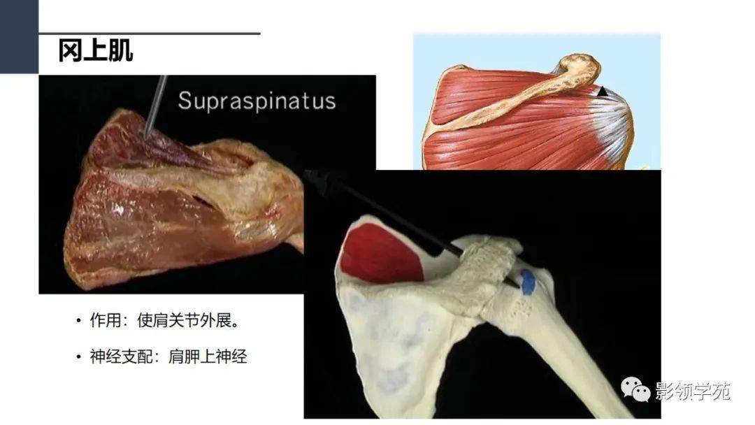 肩關節解剖及常見疾病影像表現