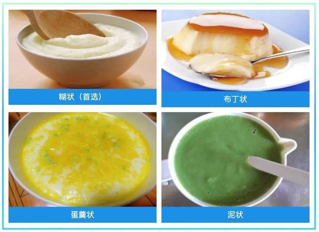 容易吞咽的食物应符合以下要求:密度均匀;黏性适当;不易松散,通过咽和