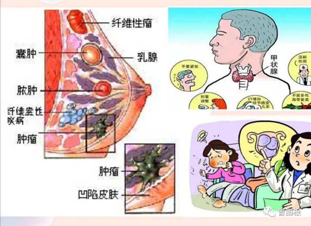 宫颈歪了的图片图片