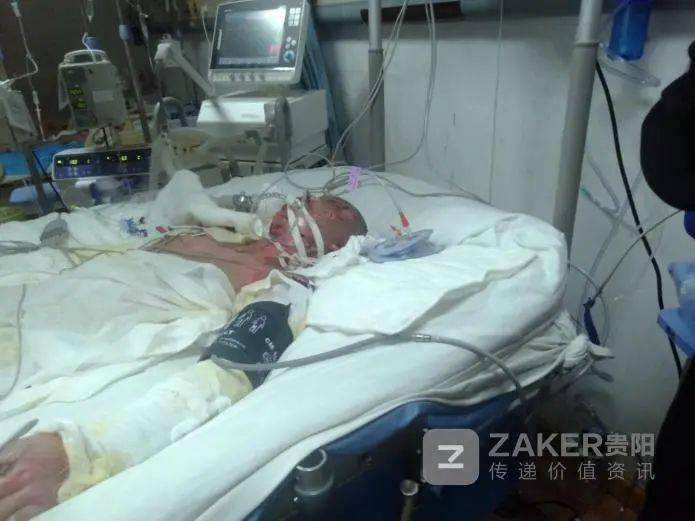 妻子在阳台上给孩子取衣服时,因热水器发生爆炸受伤,后经抢救无效去世