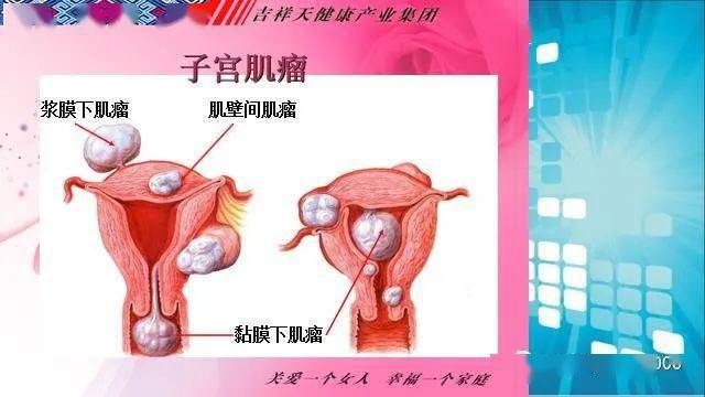 關注女性生殖健康暖女性健康之本