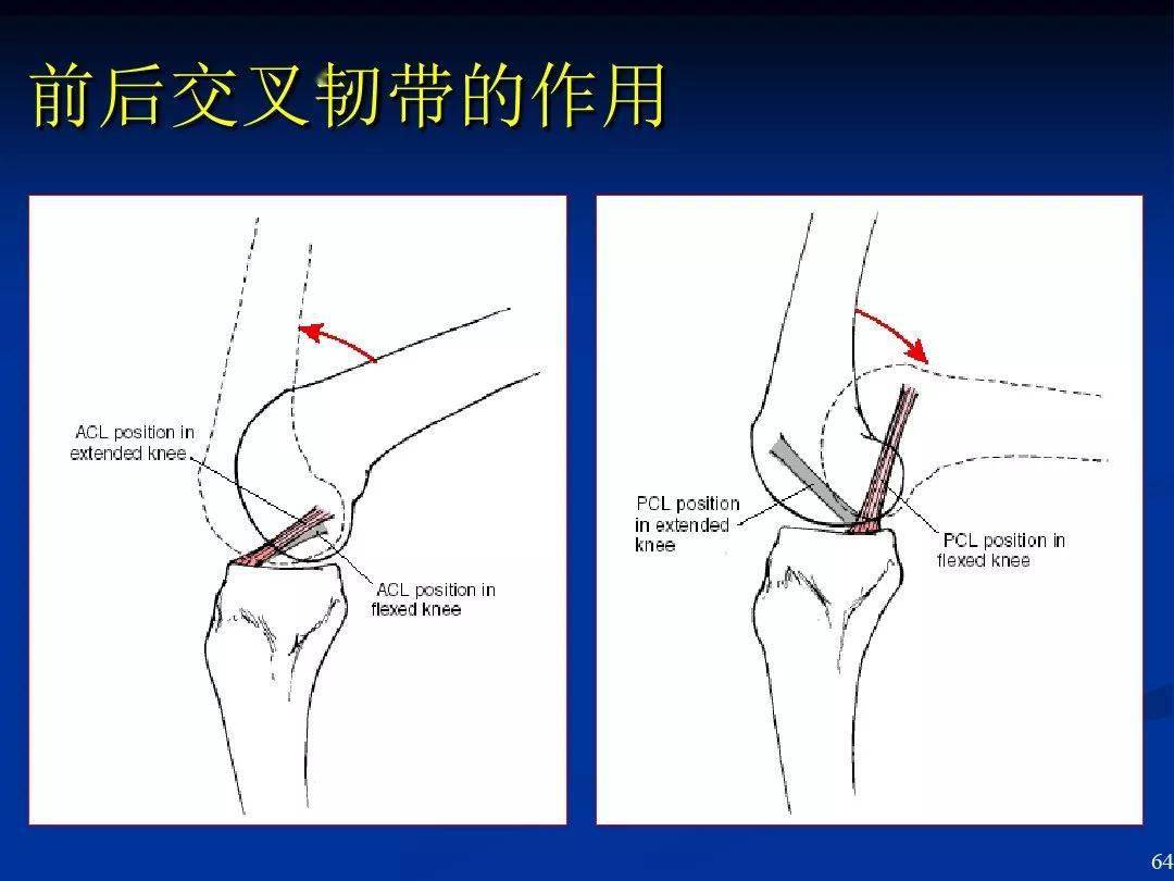 膝盖绞索可自行解开图片