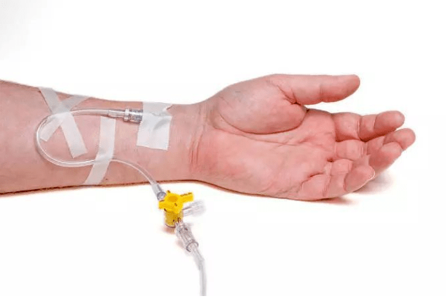 静脉输液,护士竟然倒着扎!逆行穿刺是否可行?