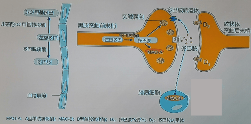 帕金森病药物治疗看完这张表就够了