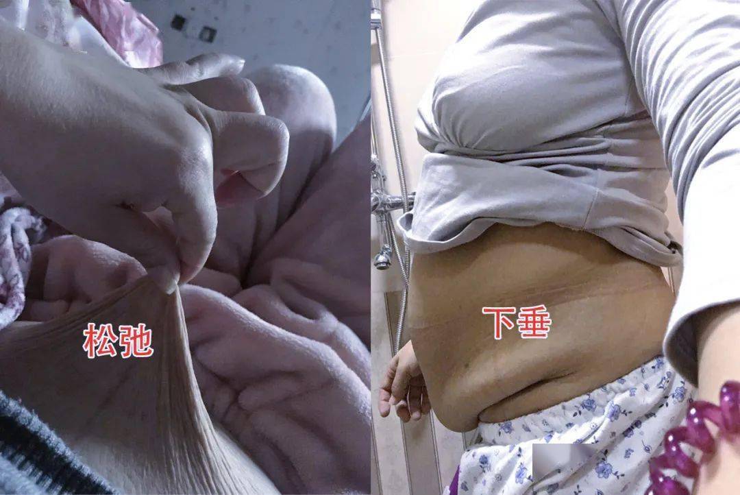 日本变态腹部抽脂带25分钟胜过卷腹368次狂甩游泳圈轻松get少女腰