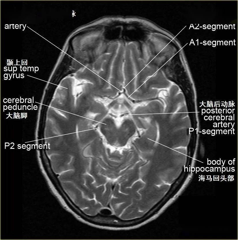 学习借鉴脑的断面解剖