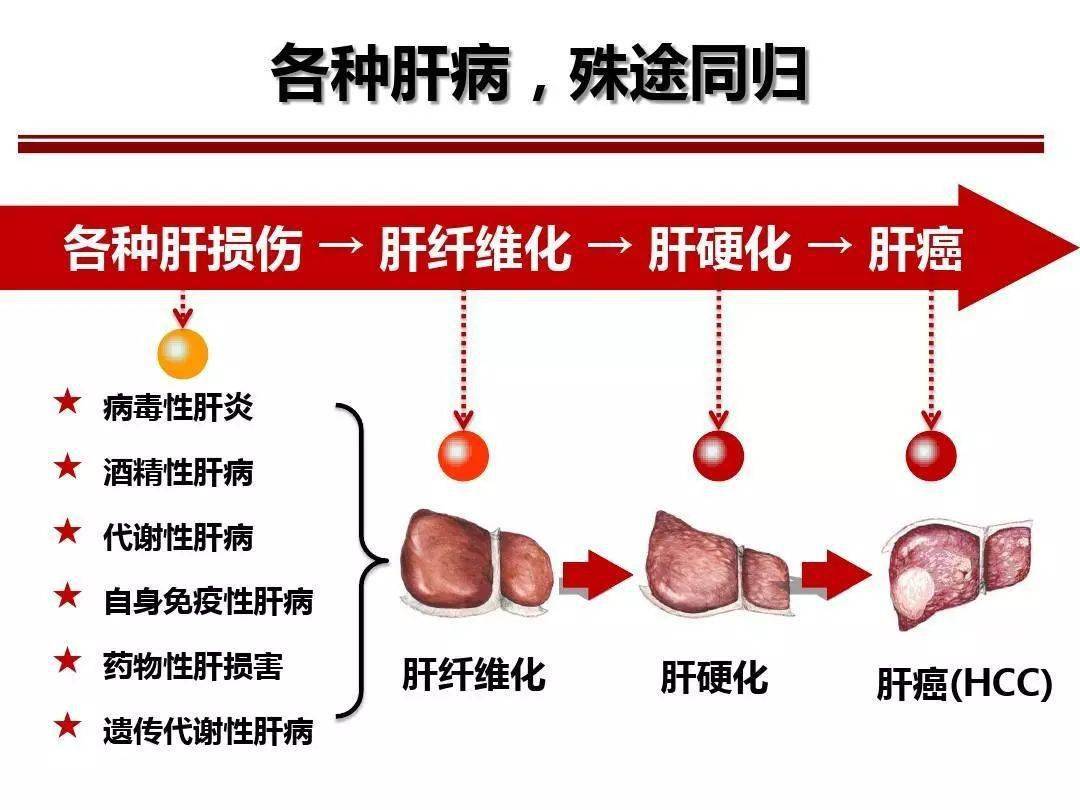 中国又获肝病大国称号养肝护肝喝羊奶