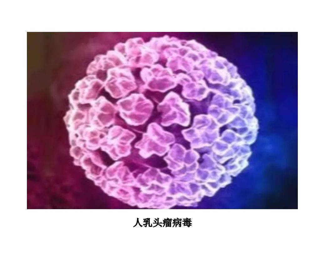 人头乳瘤病毒图片图片