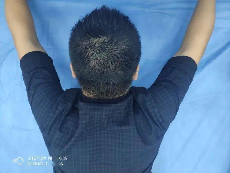 "天使之翼"不美丽——浅谈翼状肩胛