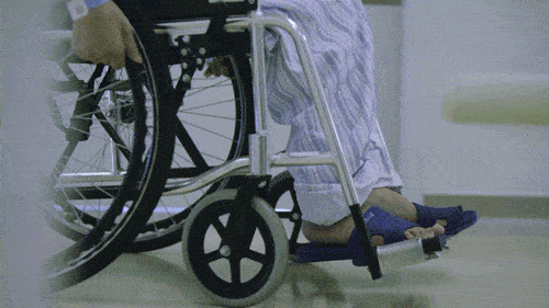 历经四次手术后,曾让全网关注的"折叠人"现在怎么样了?