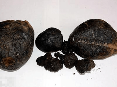 撕开毒品的伪装 | 那些年海关截获的毒品_症状