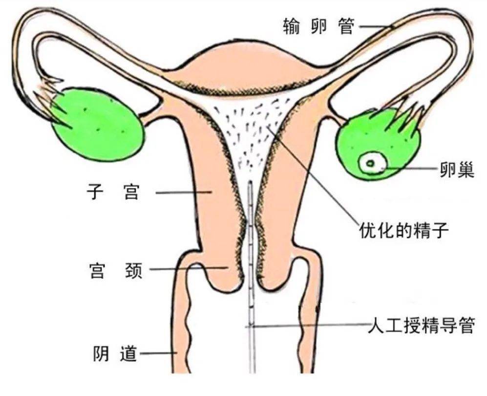 受孕全过程方法图片
