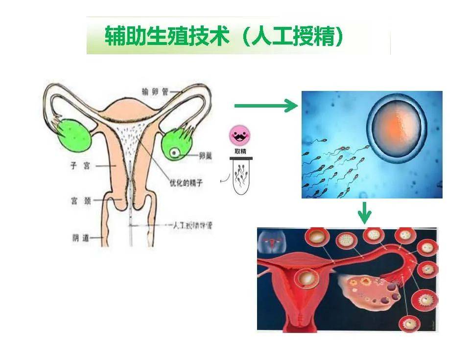 杨冬梓,医学博士,教授,博士生导师中山大学孙逸仙纪念医院妇产科生殖