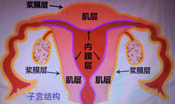 如下图所示:子宫腺肌症简单说,就是指子宫内膜(基底层的腺体和间质)长