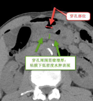 手把手教学 