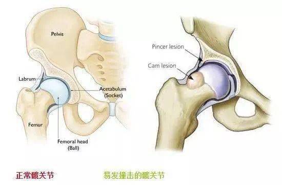 蹲錯當心把膝蓋練炸了!_膝關節