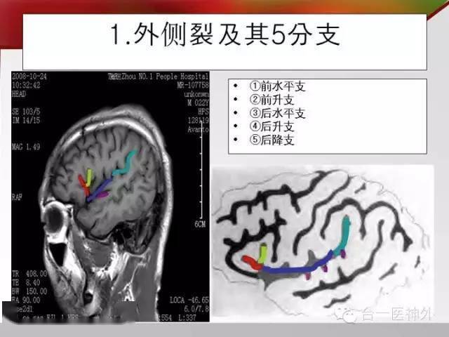 如何在ct及mri圖像上辨識腦溝回